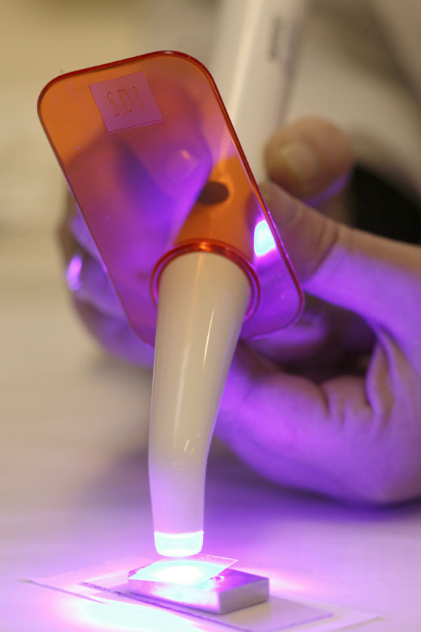 Dental curing light being used to harden tooth-colored filling material.